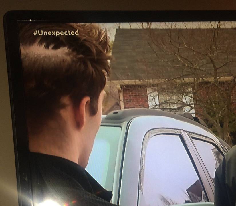 Screengrab of TLC's Unexpected showing bald patch on back of Tylor's head