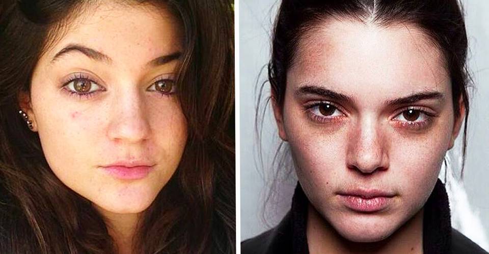 18 Pictures Of Kendall And Kylie Jenner With No Makeup On