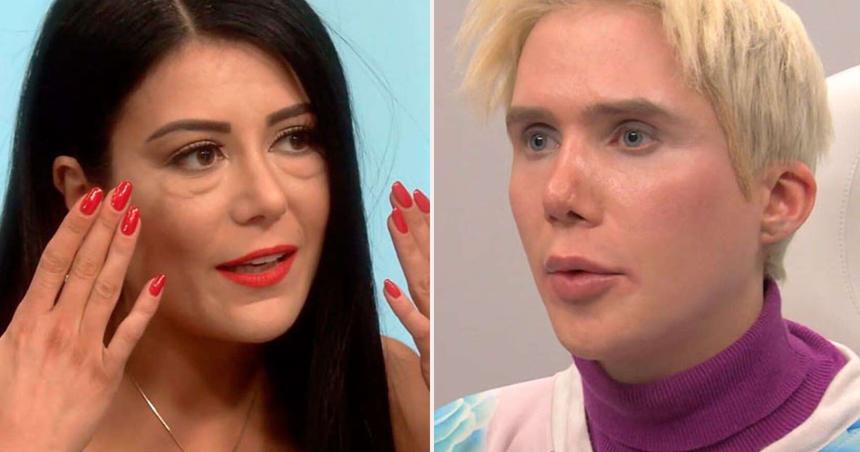 Flora from The Real World on Botched: See what Dr. Dubrow did to