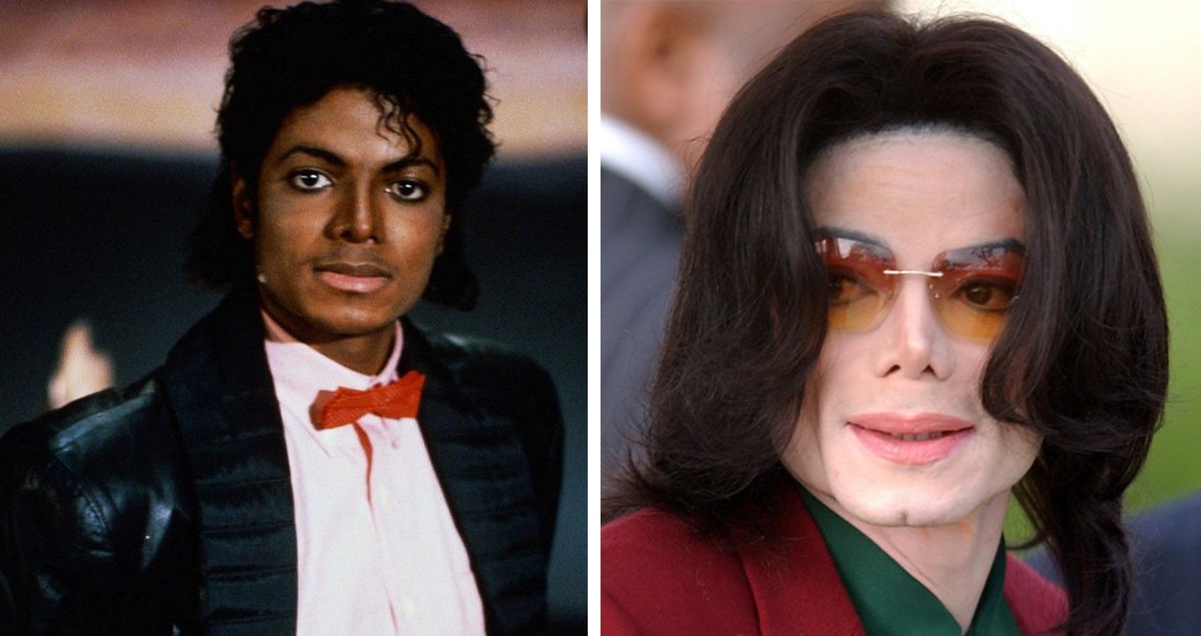 Michael Jackson Plastic Surgery Photos