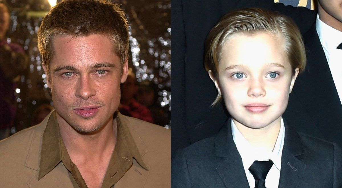 Shiloh Jolie Pitt Surgery