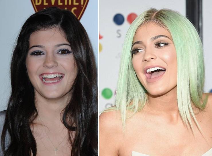 Download Zac Efron And Other Celebs Who Used To Have Way Different Teeth Desktop Wallpaper Free Wallpaper Zac Efron And Other Celebs Who Used To Have Way Different Teeth Free HD