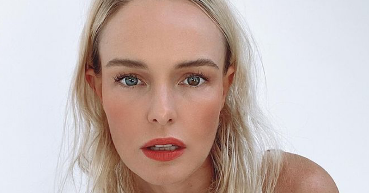 Heres Why Kate Bosworth Has Two Different Colored Eyes