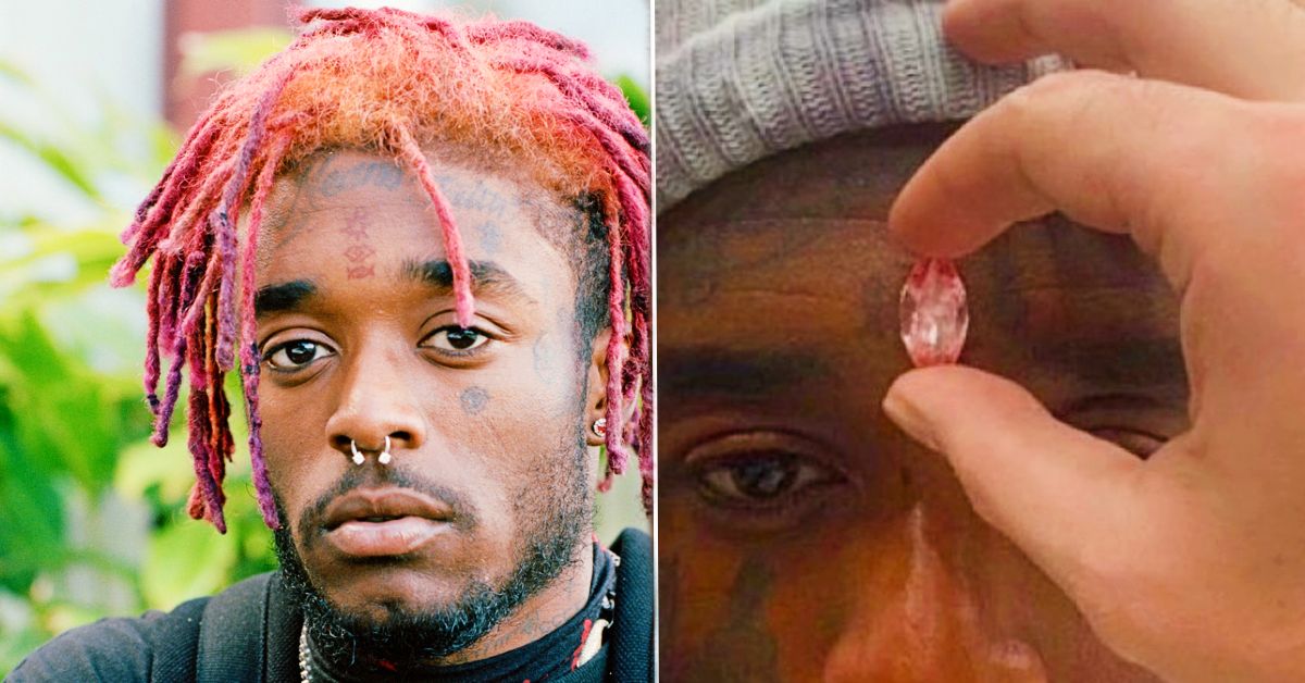 Lil Uzi Wants An Extravagant Diamond Put In His Head. Is It Even Possible?