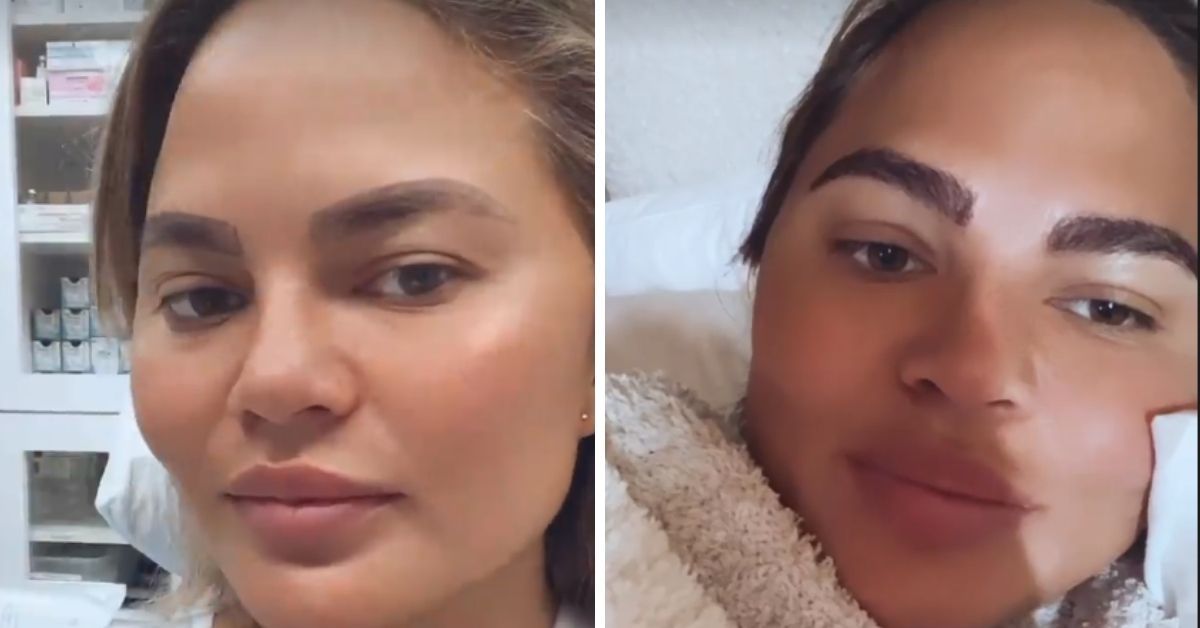 Images of Chrissy Teigen before and after 
