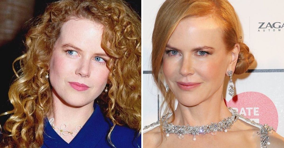 What Changes Did Nicole Kidman Make To Her Face?