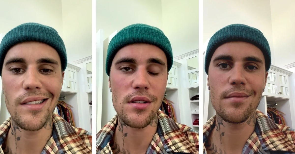 Justin Bieber showing his facial paralysis