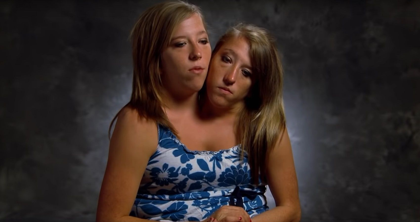 Inside Conjoined Twins Abby And Brittany's Mysterious Dating Life