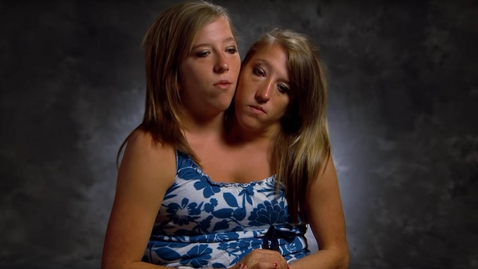 Inside Conjoined Twins Abby And Brittany's Mysterious Dating Life