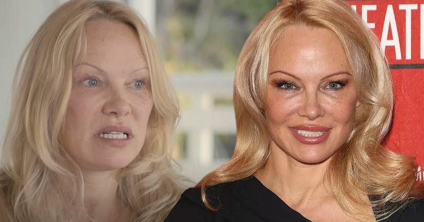 Did Pamela Anderson s Divorces And Subsequent Settlements Damage Or did-pamela-anderson-s-divorces-and-subsequent-settlements-damage-or