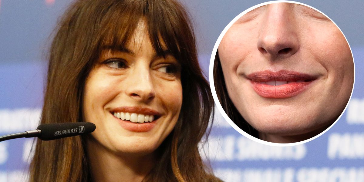 Anne Hathaway credits her imperfect nose