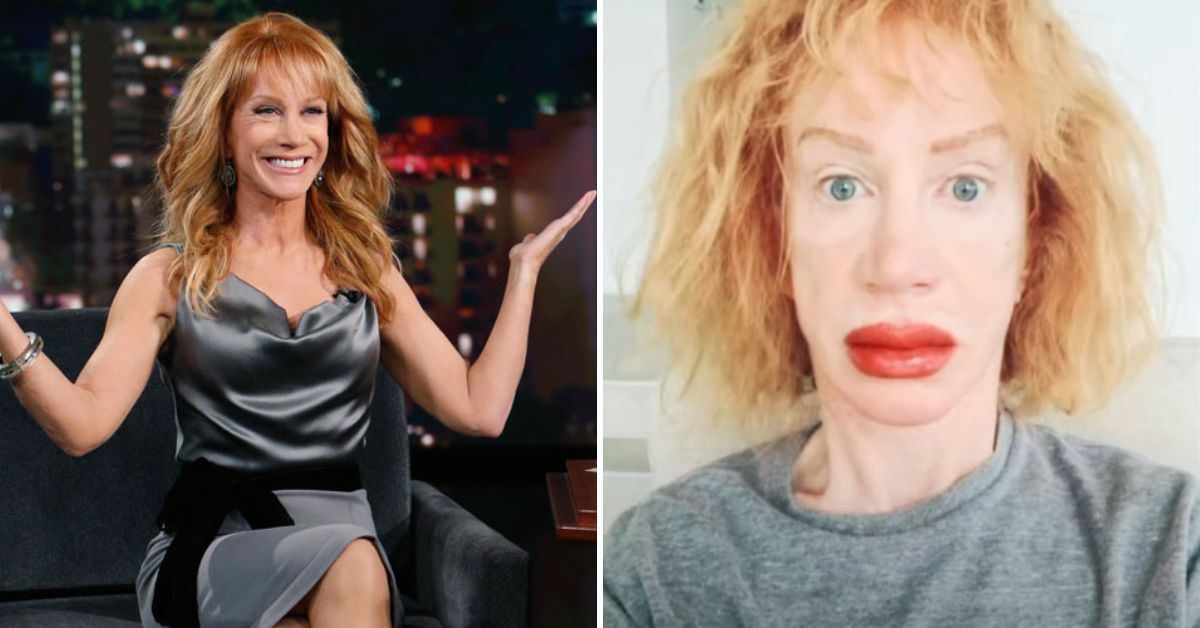 Has Kathy Griffin Spent An Absolute Fortune On Plastic Surgery? The ...