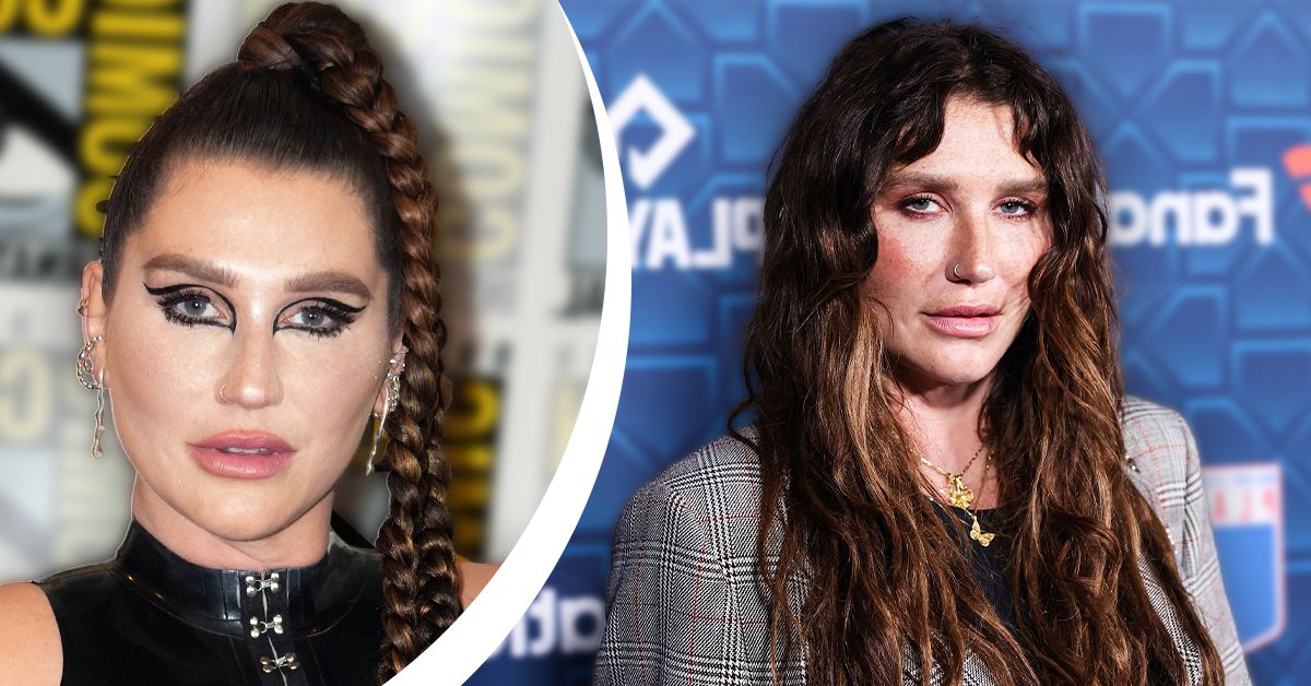 The Sad Reason You Don’t Hear About Kesha Anymore