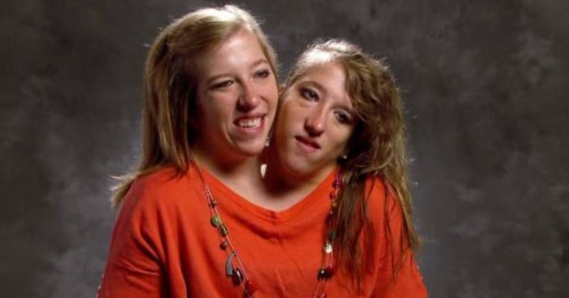 Here's What Former TLC Stars Conjoined Twins Abby And Brittany Hensel ...