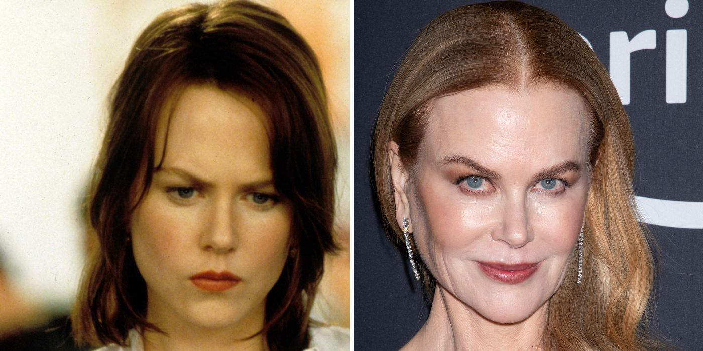 Plastic Surgeons Believe Nicole Kidman Has Had Several Cosmetic Procedures