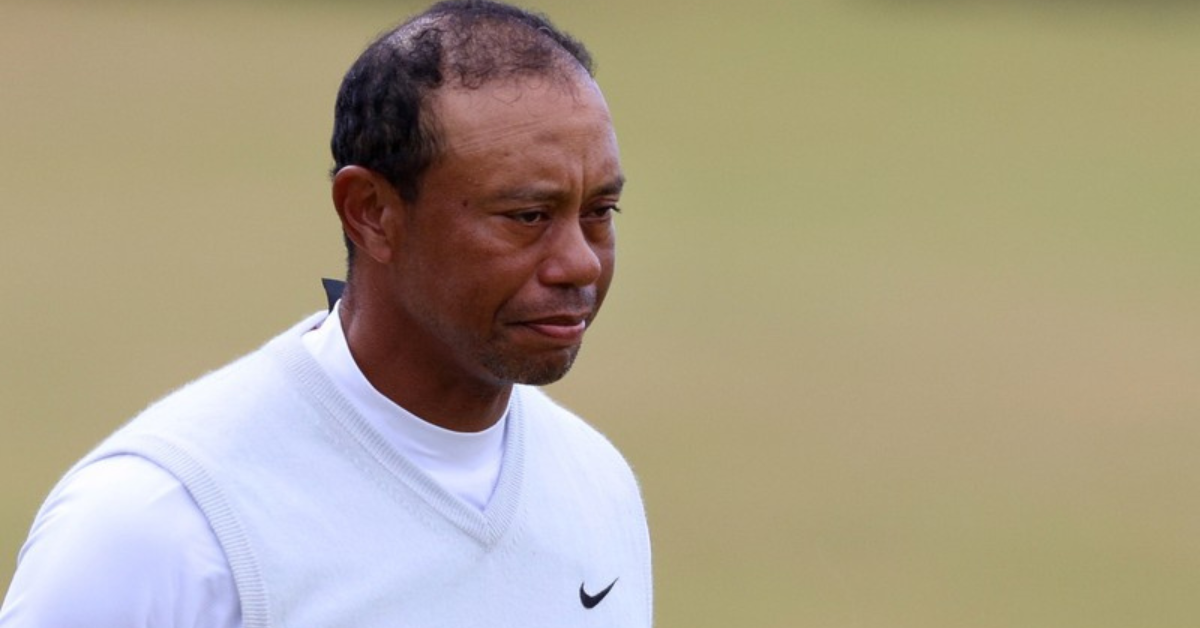 Tiger Woods Handled A Question About Balding In The Best Way Possible